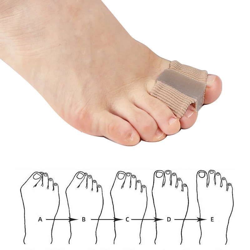 Kit 4 Peças Separador de Dedos - Yoga Toe Separator avaliação e preço