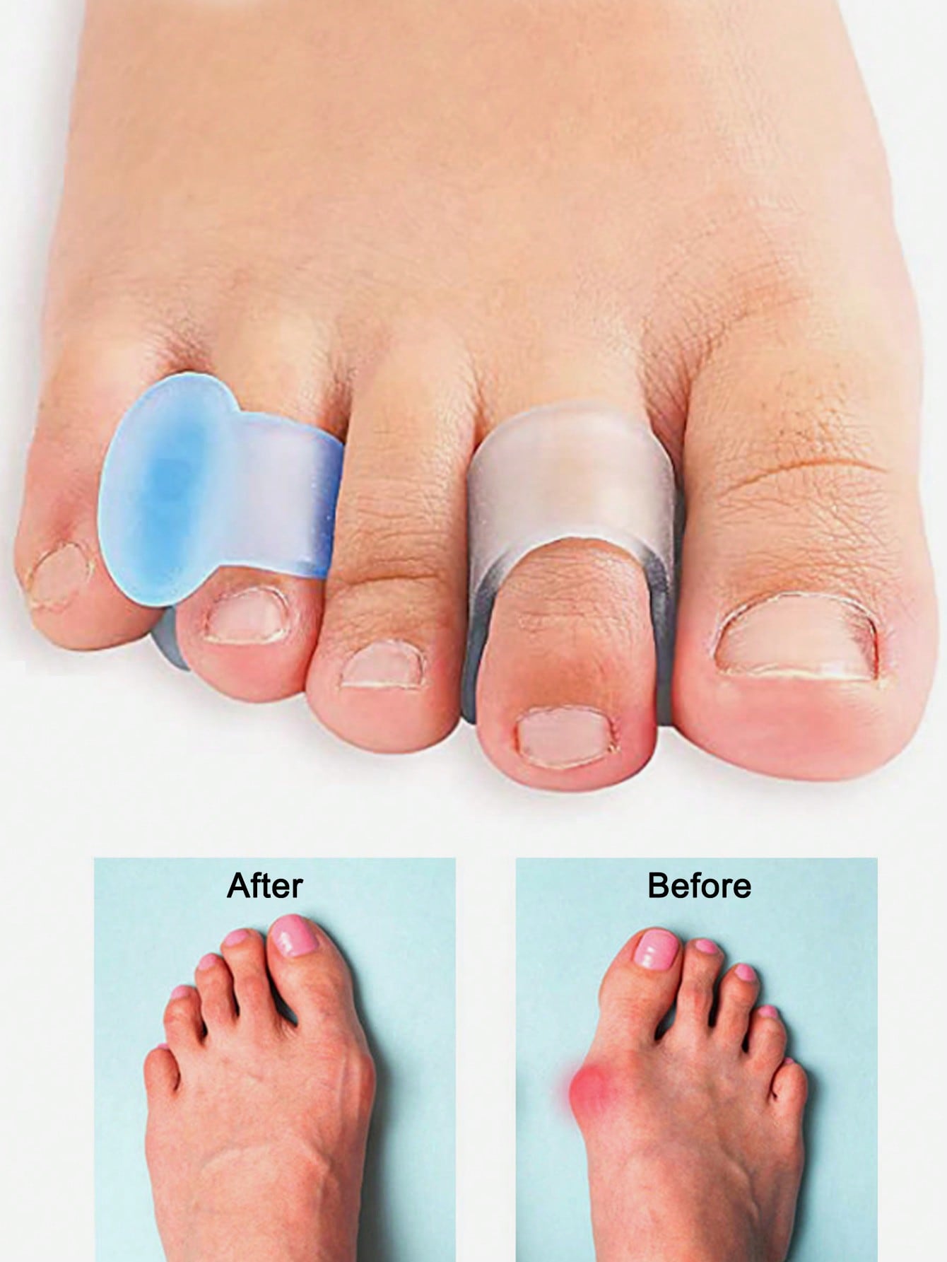 Separador de Dedos em Gel, 4 P - Yoga Toe Separator avaliação e preço